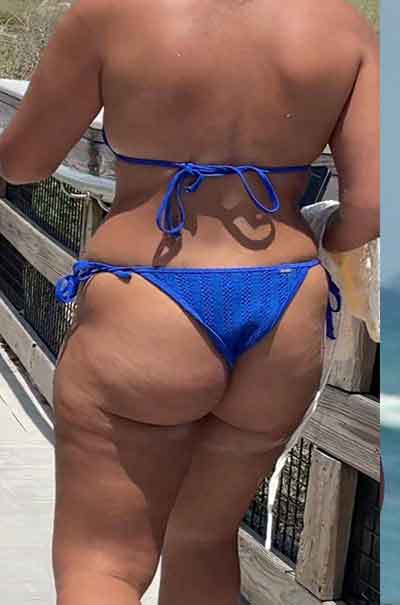 Vera, 35 år